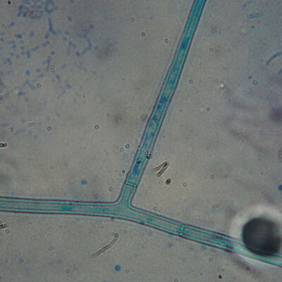 Thanatephorus cucumeris