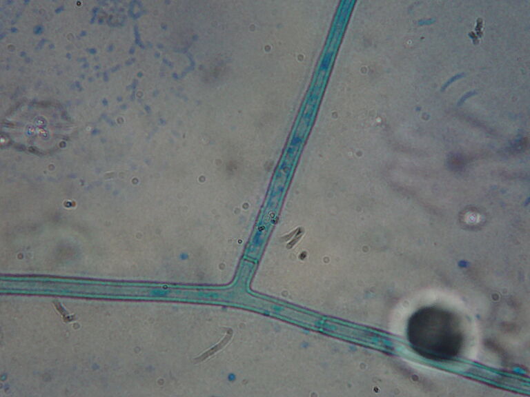 Thanatephorus cucumeris