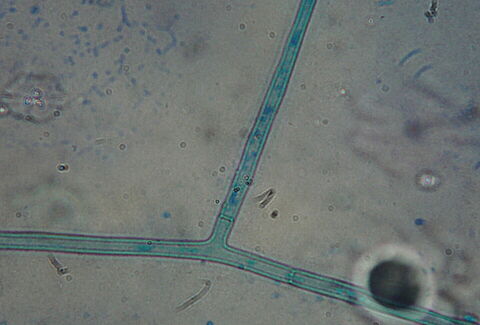 Rhizoctonia spp.